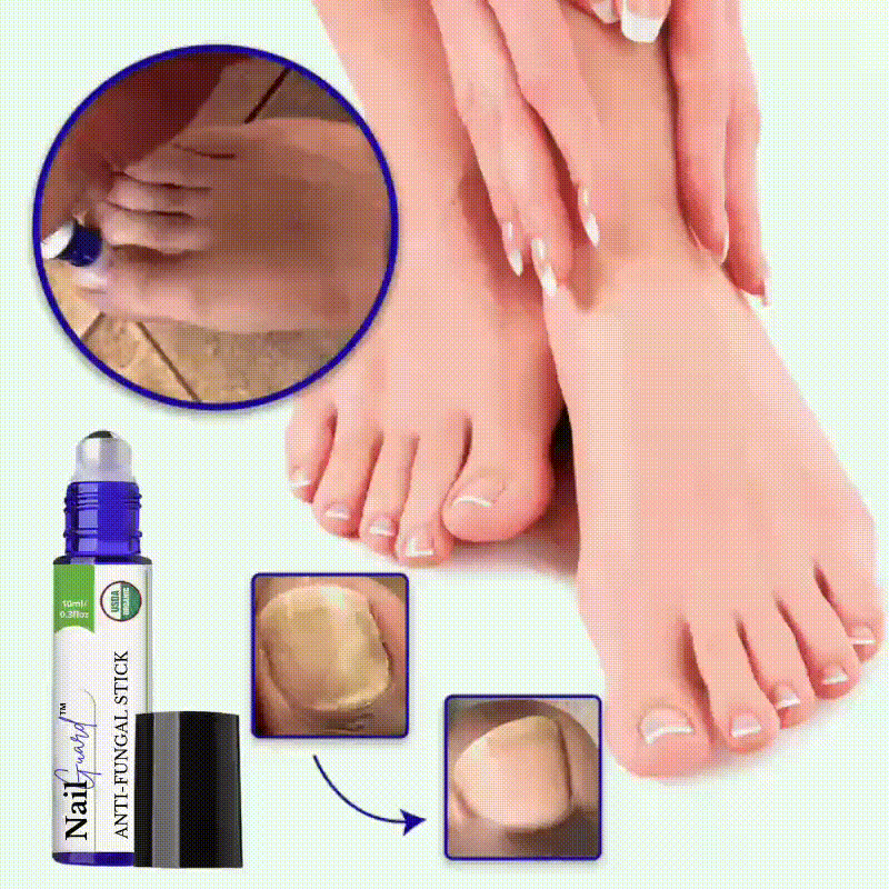NailGuard™  | Zeg Vaarwel tegen Nagelschimmel in Slechts 5 Dagen!